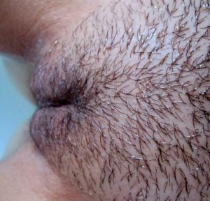 சிறிது முடி நிறைந்த கூதி 